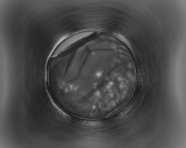 X0000086881095200705071156