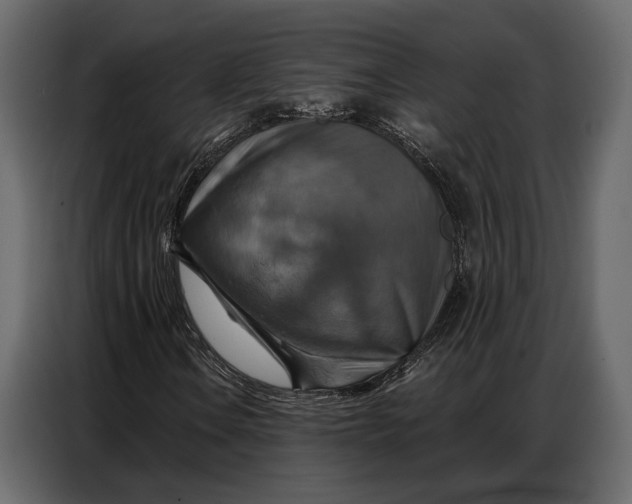 X0000086881106200705071156