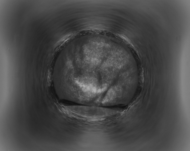 X0000086881110200705071156