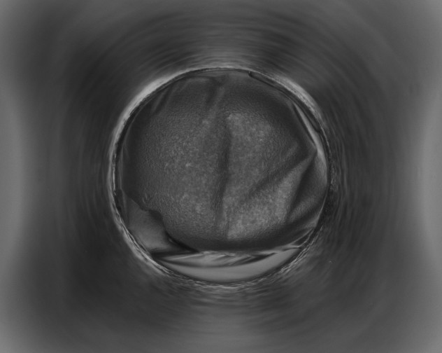 X0000086881144200705071156