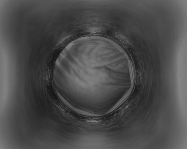 X0000086881158200705071156