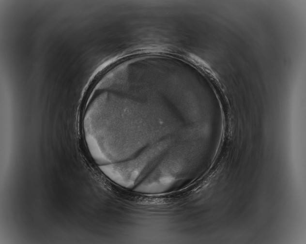 X0000086881174200705071155