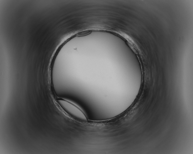 X0000086881238200705071155