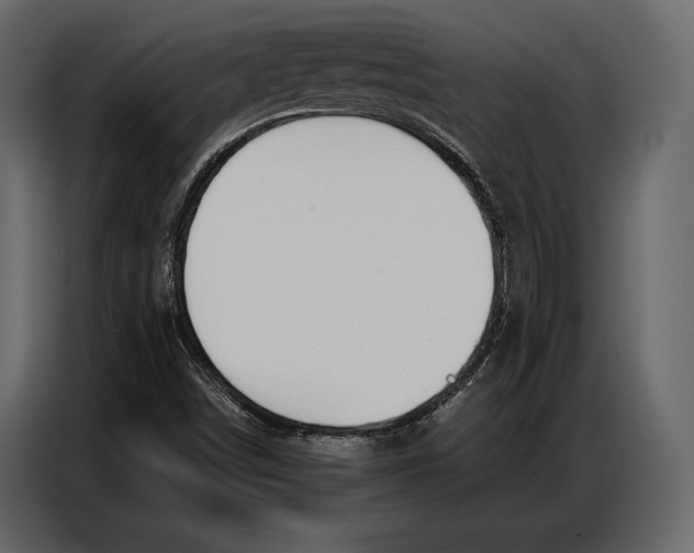 X0000086881498200705071151