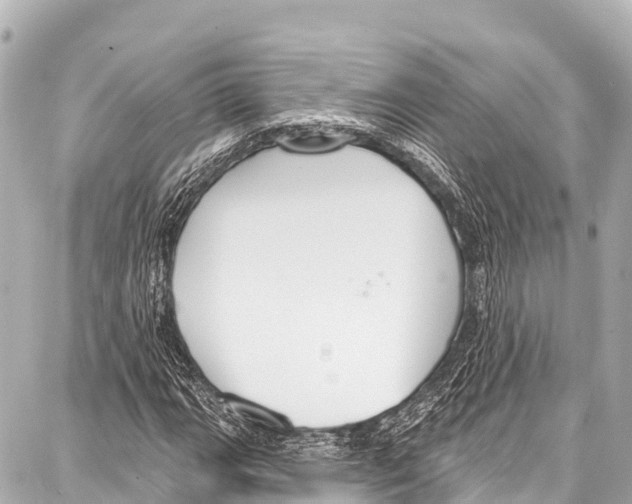 X0000086881111200705141403