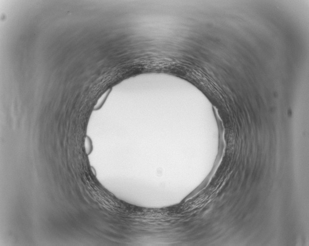 X0000086881153200705141403