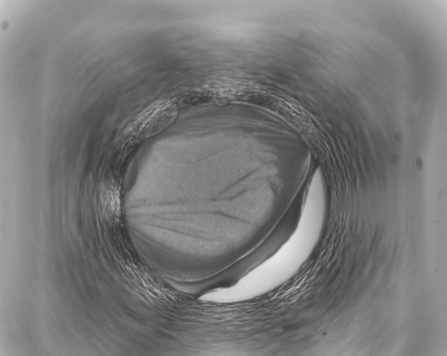 X0000086881155200705141403