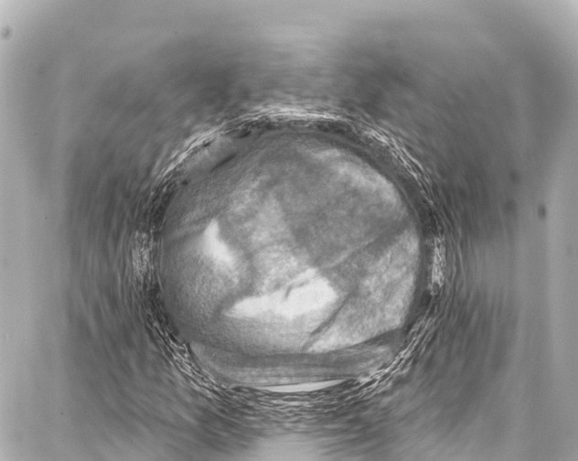 X0000086881157200705141403