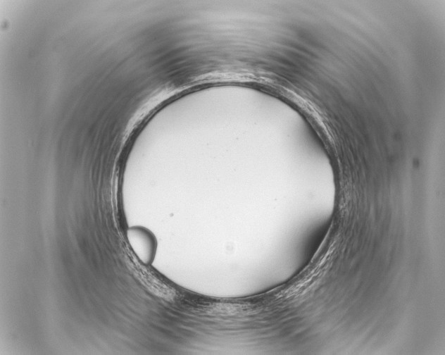 X0000086881179200705141403