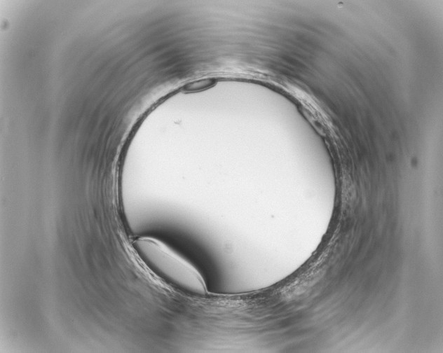 X0000086881238200705141402