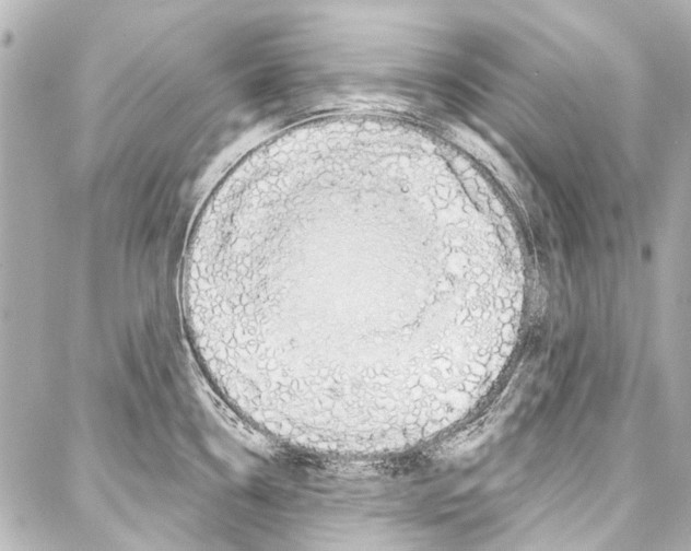 X0000086881338200705141401