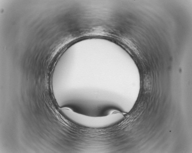 X0000086881356200705141400