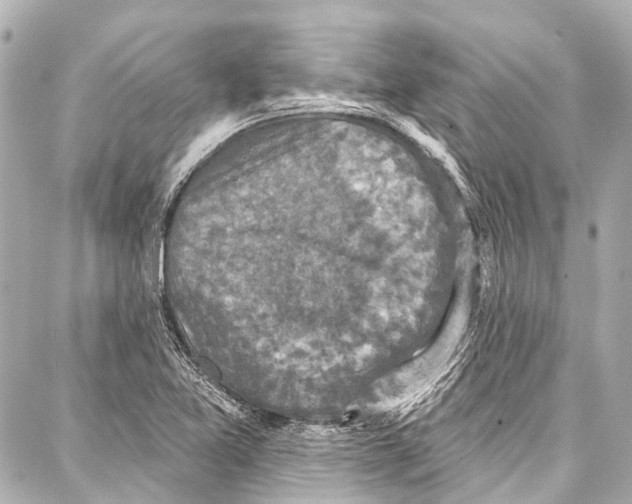 X0000086881365200705141400