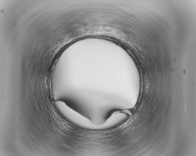 X0000086881497200705141357