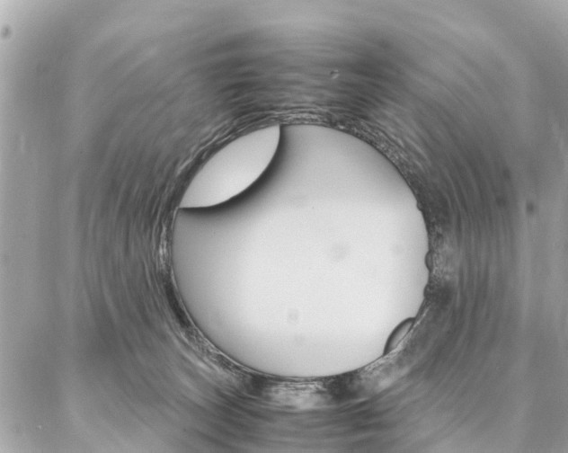 X0000086890179200704161015