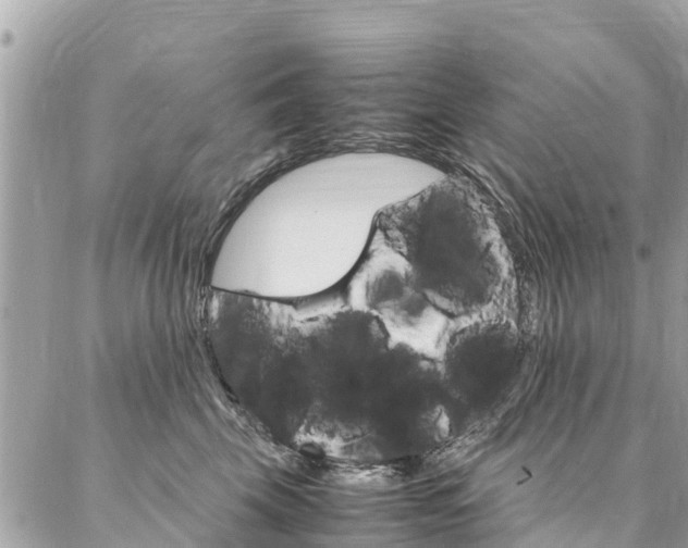 X0000086890569200704161009