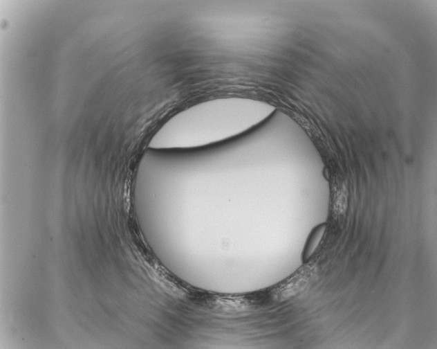 X0000086890666200704161007