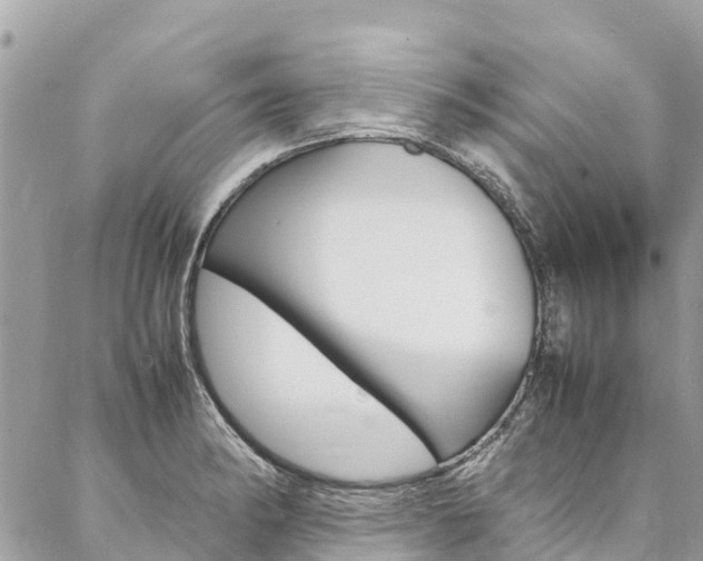 X0000086891182200704160958