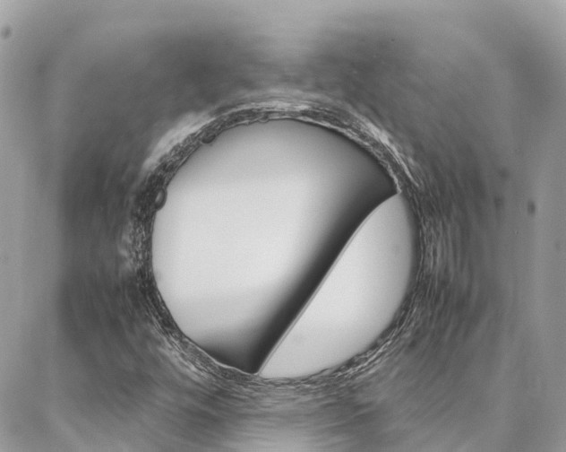X0000086891448200704160953