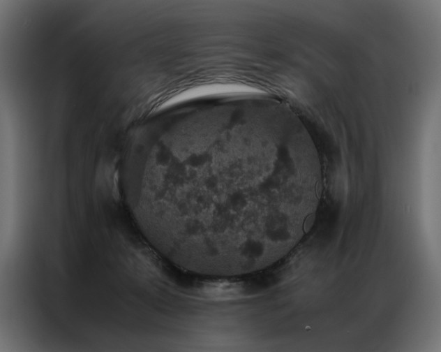 X0000086890319200704161255