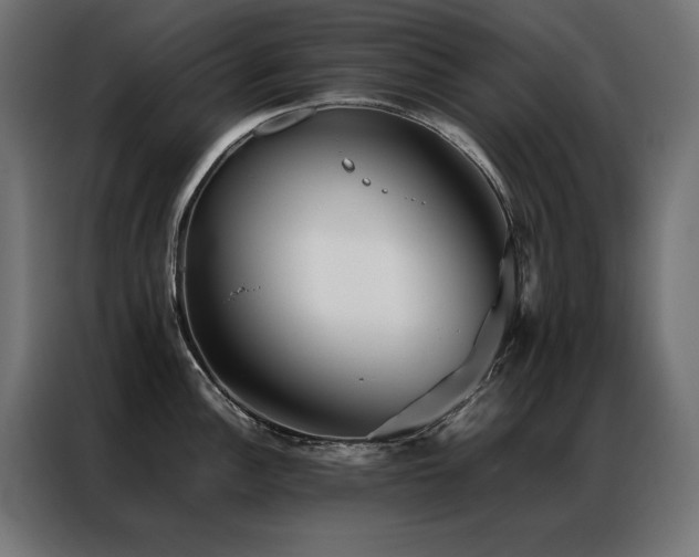 X0000086891148200704161241