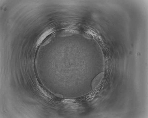 X0000086890051200704231138