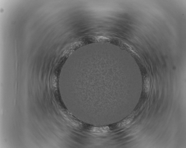 X0000086890571200704231131