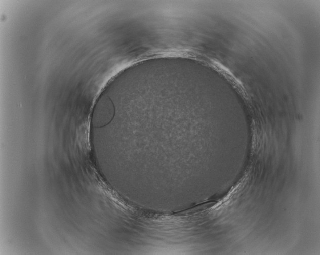 X0000086891174200704231120