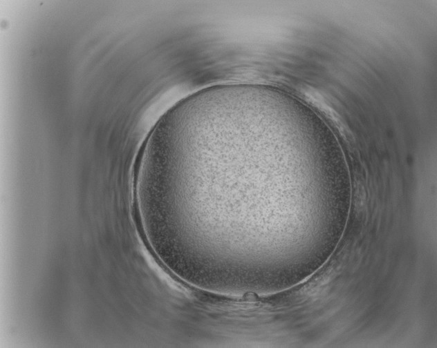 X0000086891479200704231115