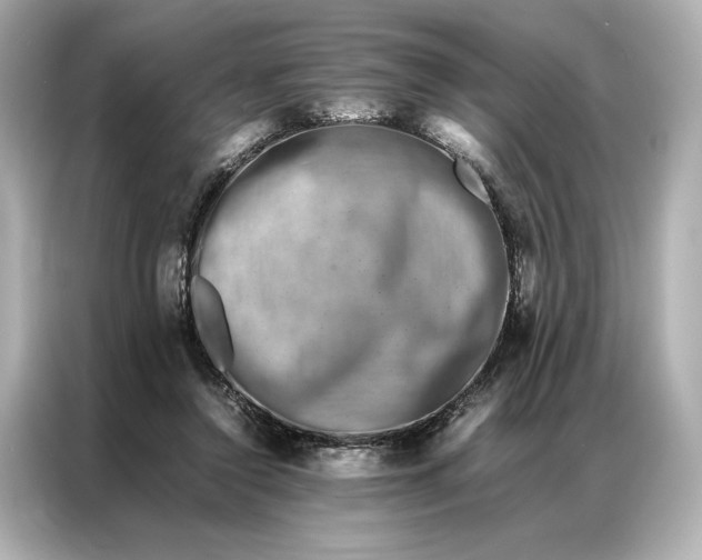 X0000086890356200704301001