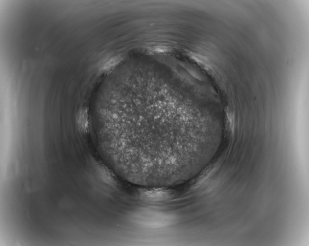 X0000086890383200704301002