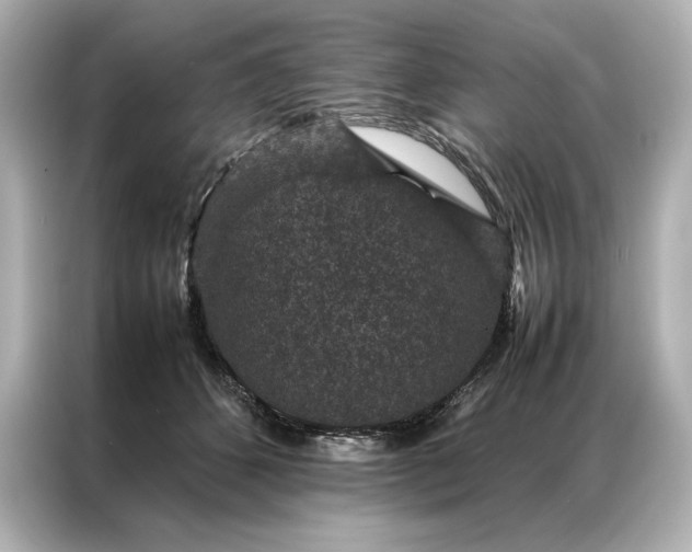 X0000086890512200704300959