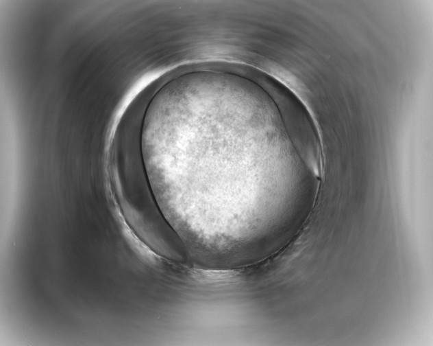 X0000086891152200704300952