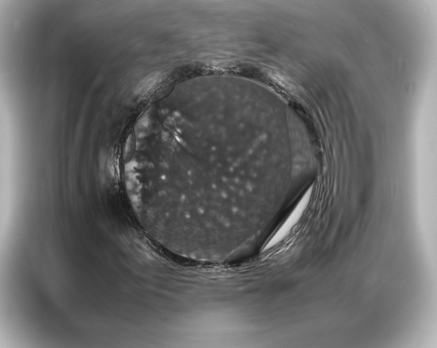 X0000086891155200704300951