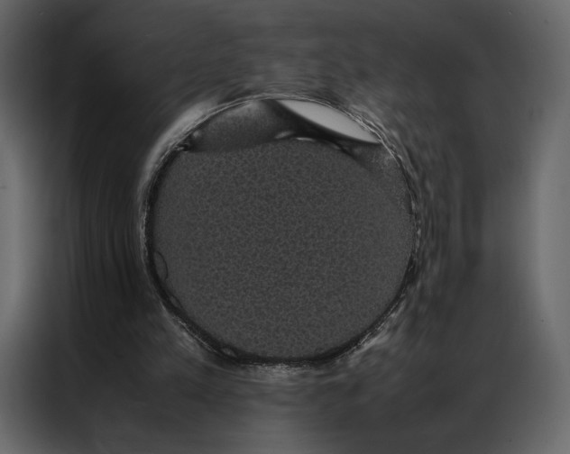 X0000086890197200705071230