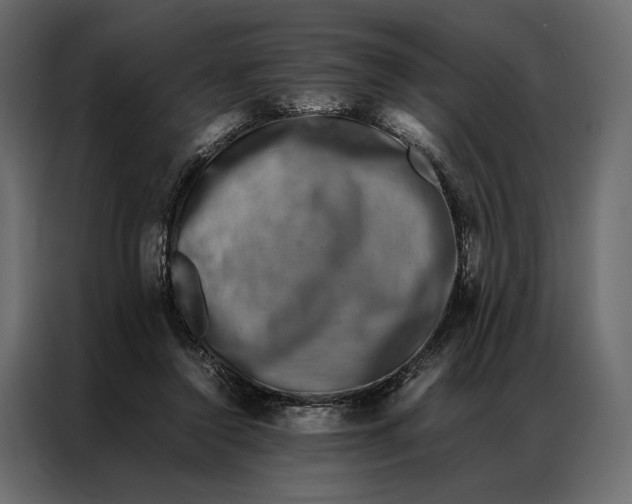 X0000086890356200705071227