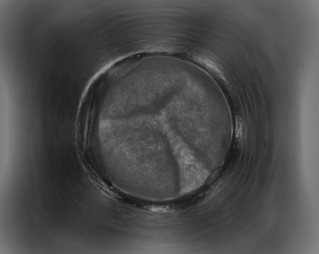 X0000086890388200705071227