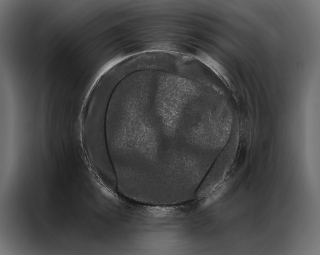 X0000086890854200705071221