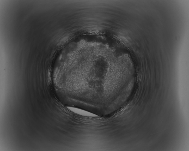 X0000086891106200705071217