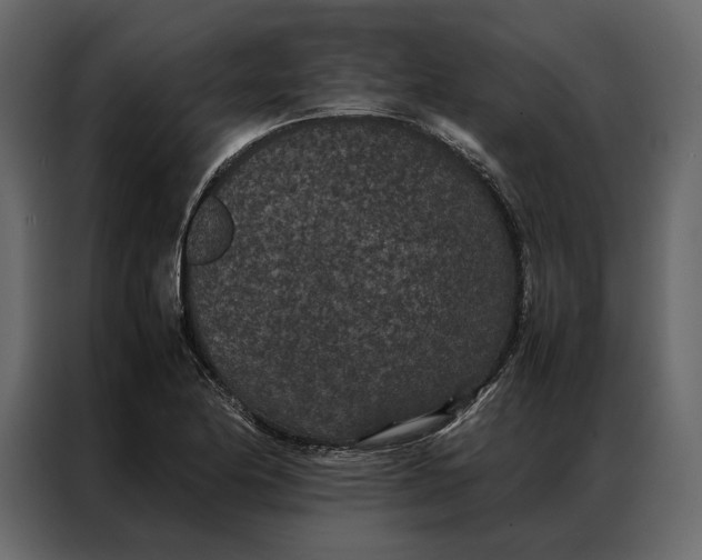 X0000086891174200705071217