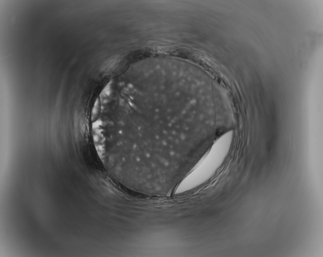 X0000086891155200705141617