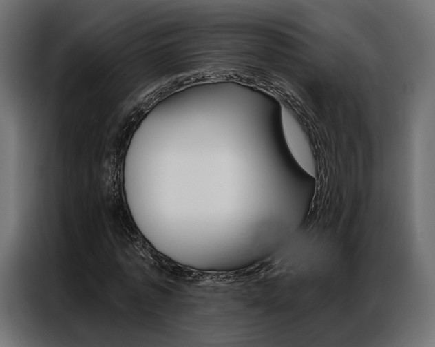 X0000086900773200704160946