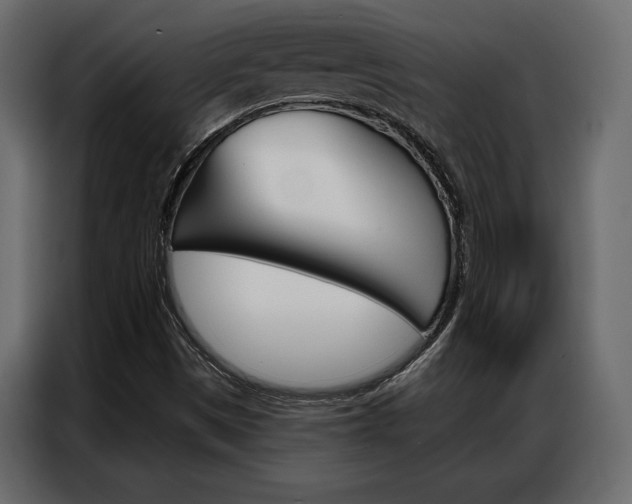 X0000086901497200704160935