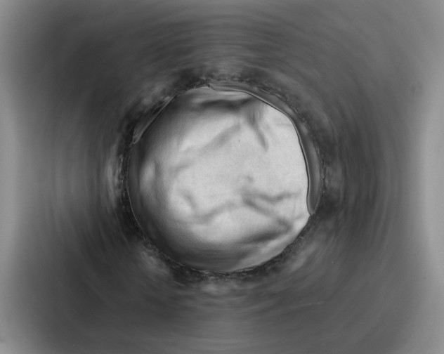 X0000086900818200705141640