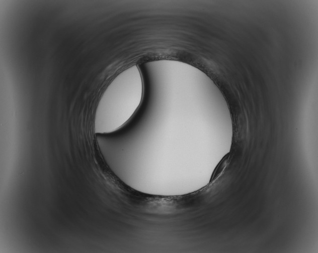 X0000086910140200704161017
