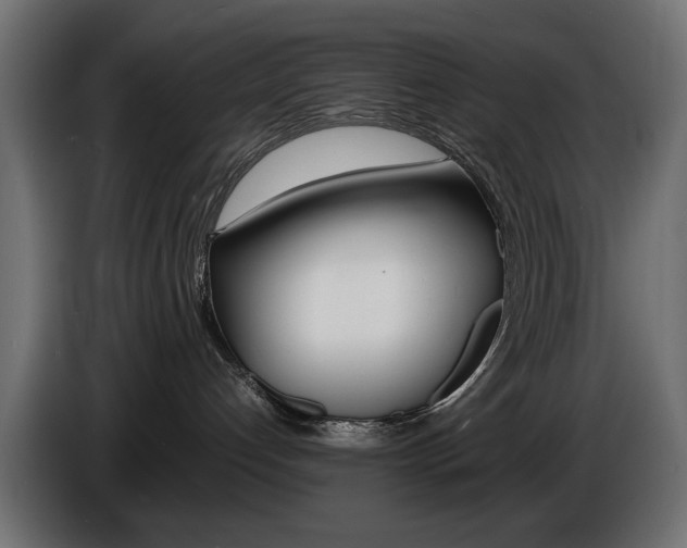 X0000086910192200704161017
