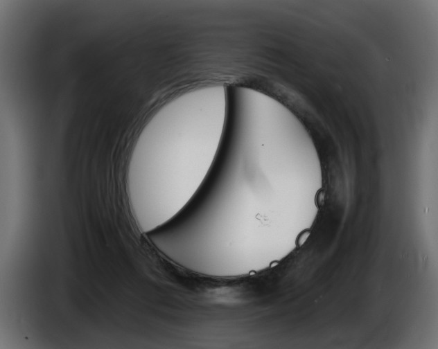 X0000086910312200704161015