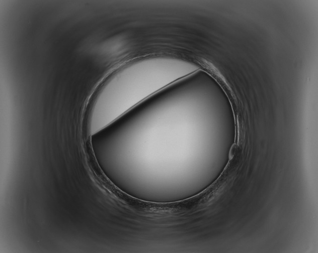 X0000086910435200704161012