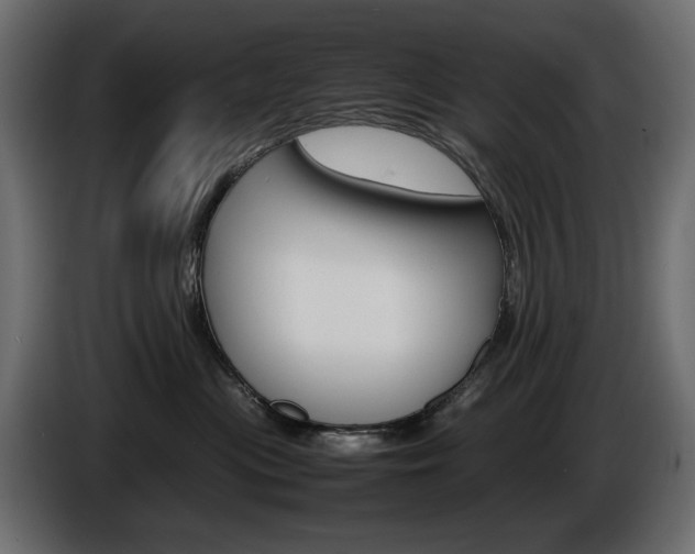 X0000086910477200704161013
