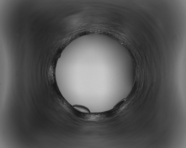 X0000086910575200704161012